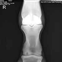digitalxray.jpg