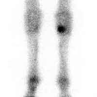 nucscan.jpg